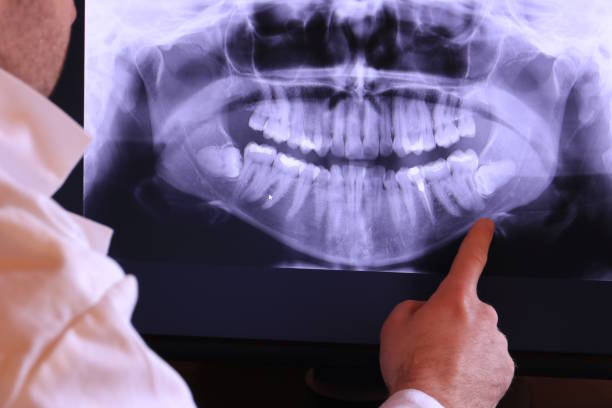 Best Emergency Dental Care for Broken or Chipped Teeth in Norfolk, NE